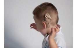 英国艾希特大学论文代写：Cochlear Implant
